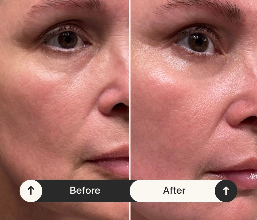 Facelift in a Bottle (Hyaluronic Acid B5 Peptide Booster)