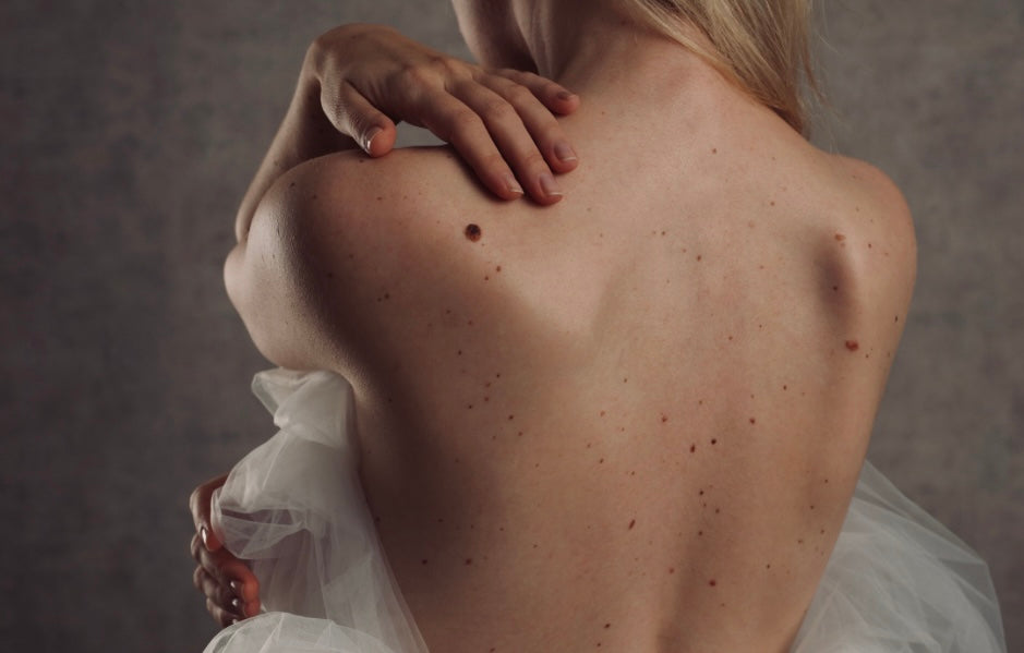 November is National Healthy Skin Month: Tips for Achieving Healthy, B ...